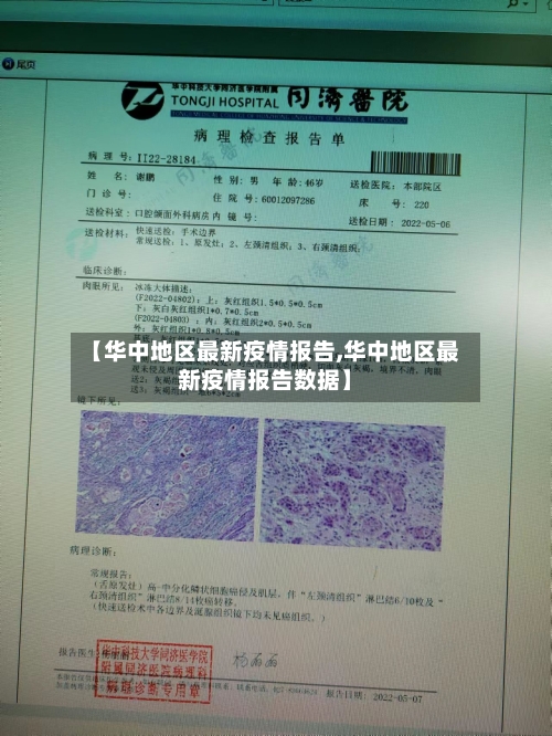 【华中地区最新疫情报告,华中地区最新疫情报告数据】-第1张图片