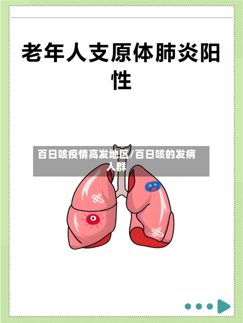 百日咳疫情高发地区/百日咳的发病人群-第1张图片